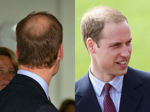 史上最酷地中海发型,马云上榜